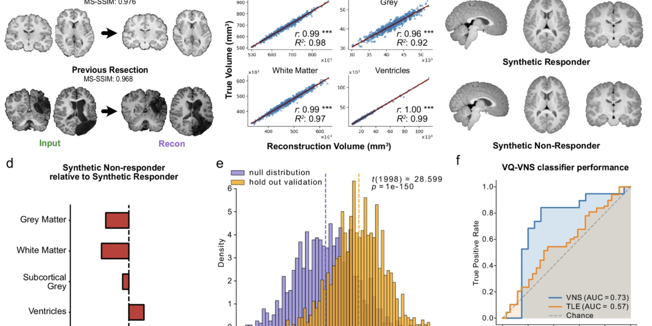 A deep representation learning model to predict response to vagus nerve stimulation