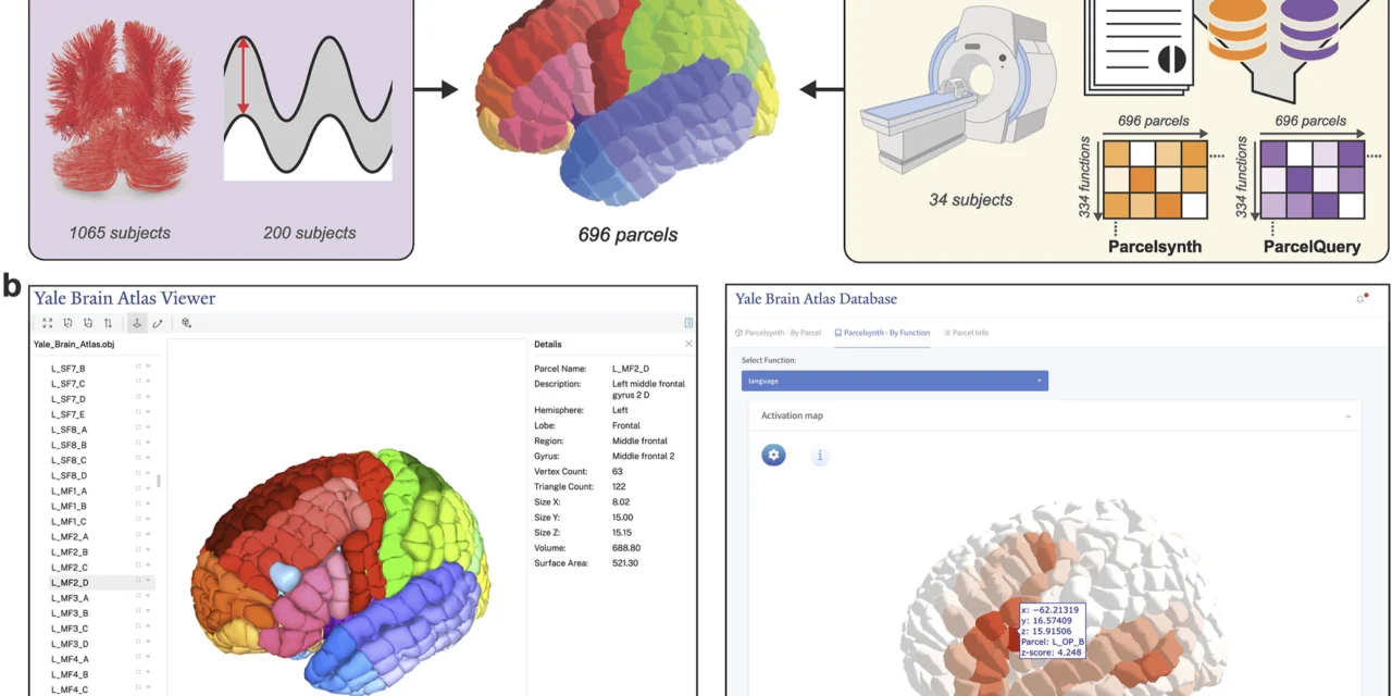 Yale Brain Atlas to interactively explore multimodal structural and functional neuroimaging data